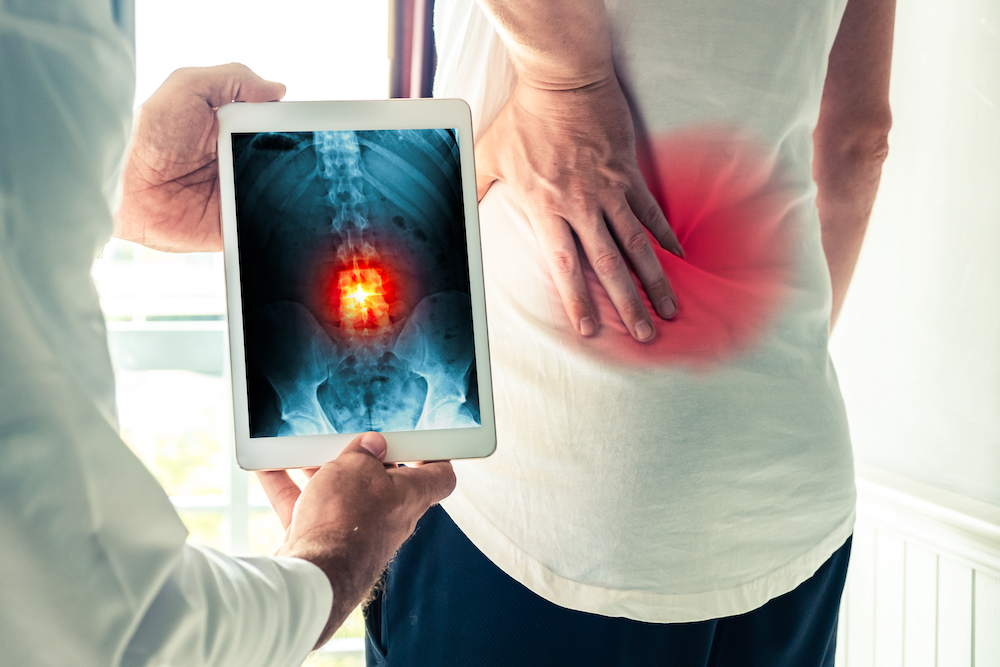 doctor showing the point of pain in the x-ray result